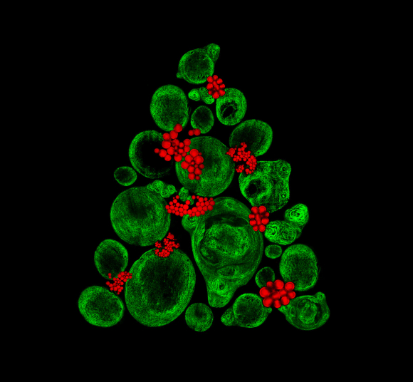 Crecimiento de tejido tipo cartílago en el laboratorio utilizando células madre de hueso (fibras de colágeno en depósitos verdes y grasas en rojo).