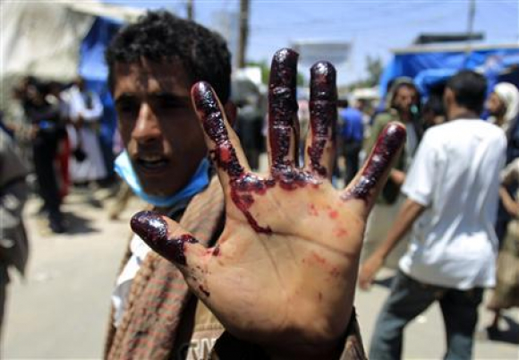 La escalada del conflicto bélico en Yemen causa 12 muertos