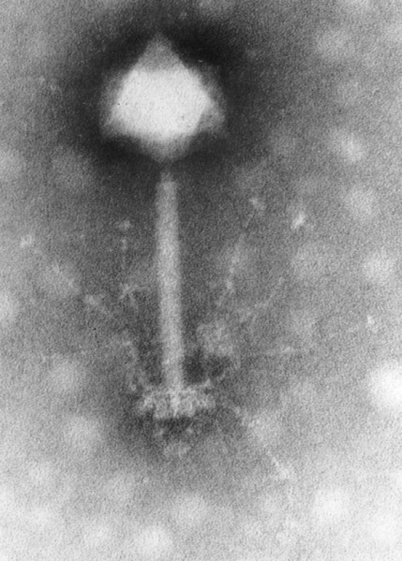 Imagen de un virus al microscopio. / Hans Wolfgang