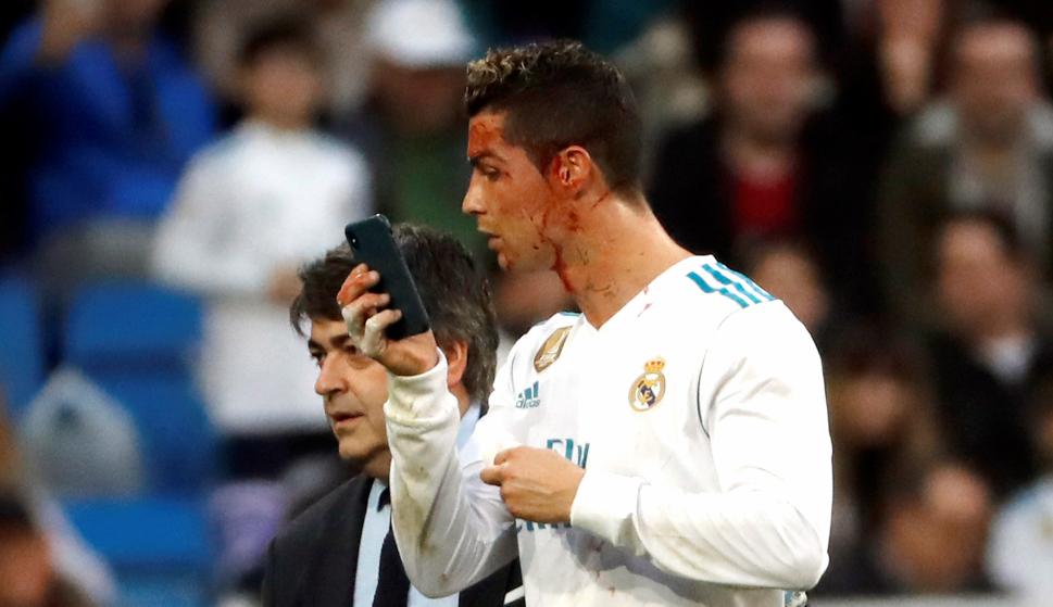 El delantero portugués del Real Madrid, Cristiano Ronaldo, se mira en un teléfono móvil tras ser golpeado en la cara durante el partido de la vigésima jornada de Liga que disputan esta tarde ante el Deportivo en el estadio Santiago Bernabéu de Madrid. EFE