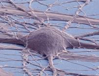 Células madre neuronales de la médula espinal