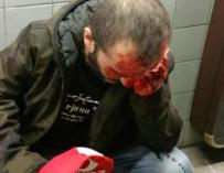 El hombre agredido en el metro de Barcelona tras la manifestación de Jusapol (Twitter)