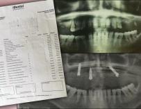 Radiografía boca