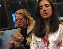 Melania Geymonat (d.) y su novia, tras la agresión que sufrieron en un autobús de Londres el 30 de mayo. /Facebook