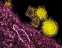 Científicos diseñan una cepa del coronavirus MERS para su uso en una vacuna