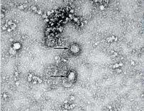 El coronavirus de Wuhan aislado por los científicos chinos. /CDC