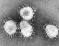 Primer caso de defunción por el coronavirus en Argelia